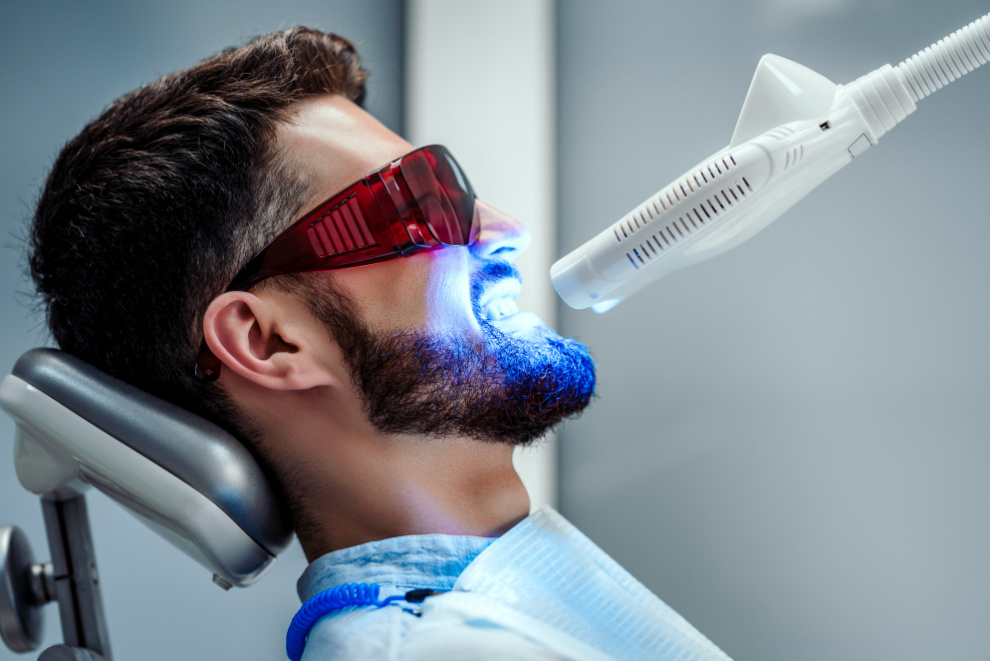 Zahnarzt Paderborn Bleaching